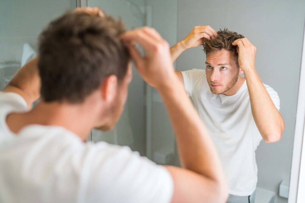 Guy with a good result after a Hair Transplant in Turkey